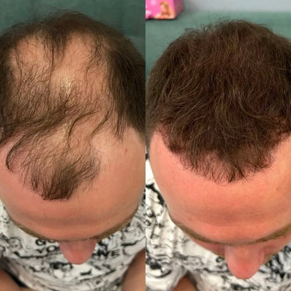 HairThrive™