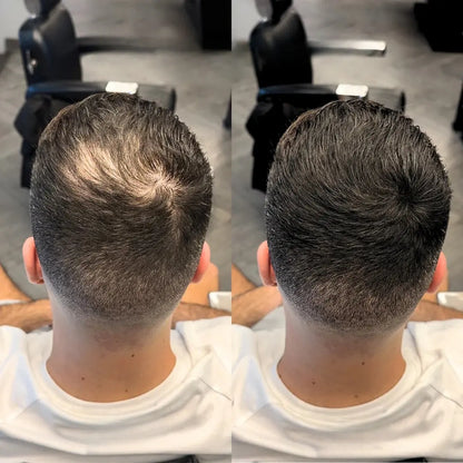 HairThrive™